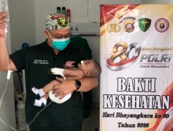 Operasi Bibir Sumbing Gratis Di Rumkit Bhayangkara Polda Kalbar Wujud Kepedulian Polri Dalam Rangka HUT Bhayangkara Ke-80